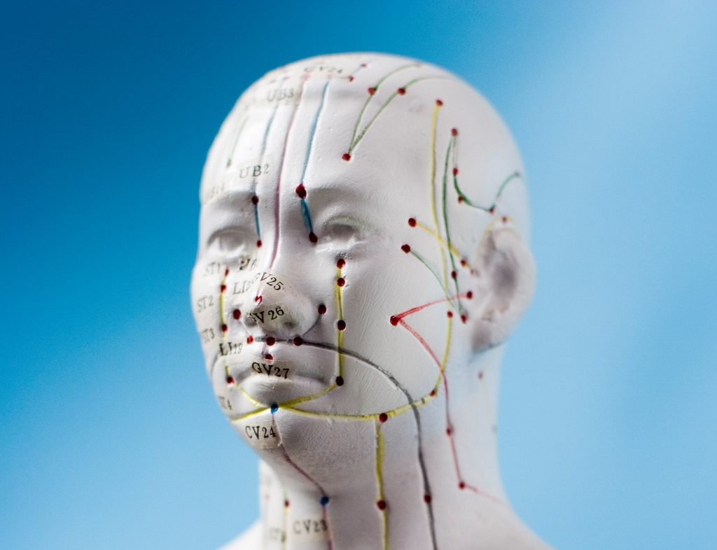 Acupuncture points for migraine and headache treatment