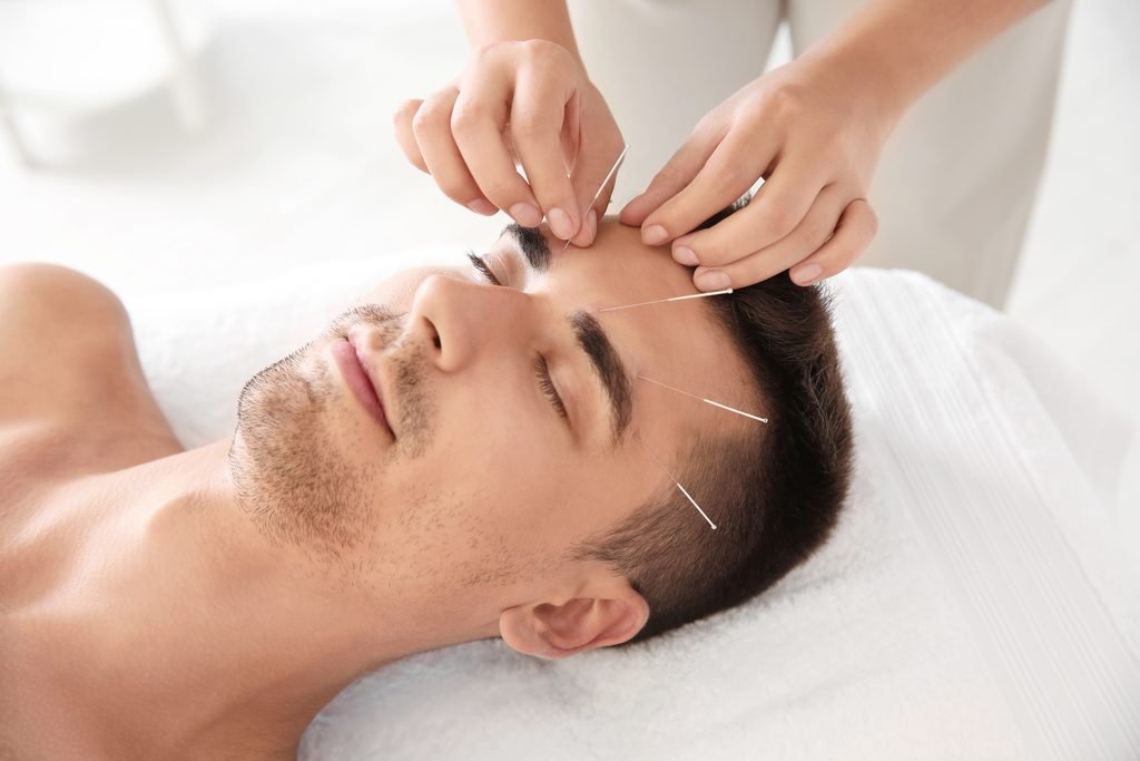 Acupuncture to reduce stress