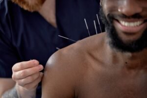 Acupuncture for Back Pain & Sciatica