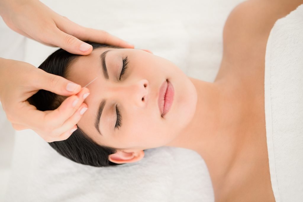 Acupuncture for anxiaety in whitecourt Alberta